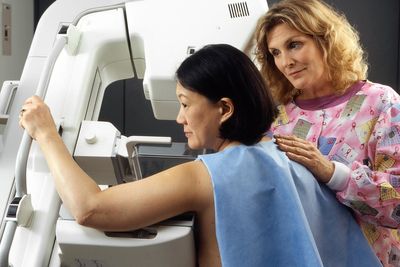 AI could transform breast cancer screening after landmark trial