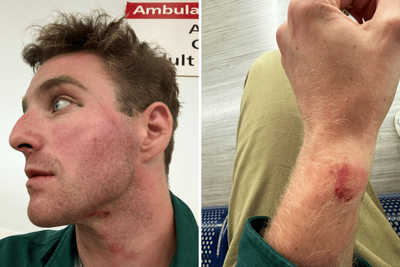 Roald Dahl’s Met officer grandson blasts own force over botched pickpocket asssault probe