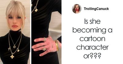 “I Hope To God This Is Photoshopped”: Photo Of Kelly Osbourne’s Hand Sparks Fan Concern