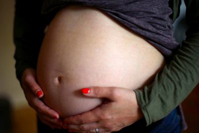 Obesity in pregnancy ‘contributing to avoidable harm’ as doctors issue new warning
