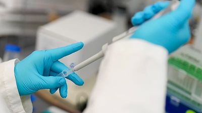 World Cancer Day: These are the top most preventable causes of cancer, new study finds