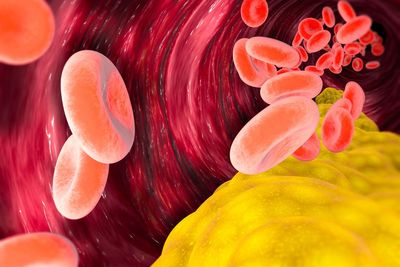 Experimental pill may offer new cholesterol-lowering option for millions