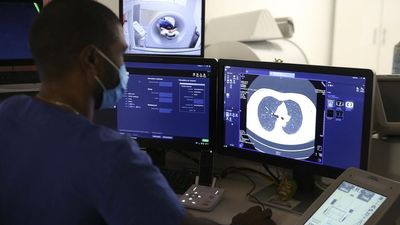 France hopes to make screening for lung cancer routine by 2030