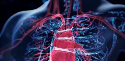 Overactive immune cells can worsen heart failure – targeting them could offer new treatments