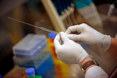 A new stem cell treatment could offer hope for people living with Parkinson’s