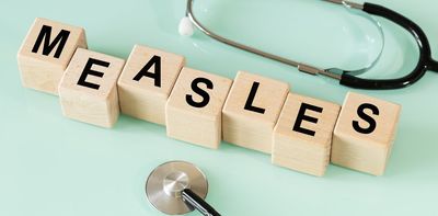 US experiencing largest measles outbreak since 2000 – 5 essential reads on the risks, what to do and what’s coming next