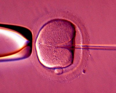 Almost 70% of NHS areas in England offer only one cycle of IVF, data shows