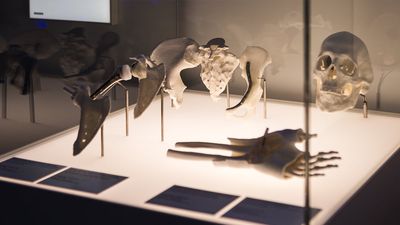 Surgeons harness tech to fix teen’s facial trauma because ‘just good enough’ wasn’t going to cut it anymore