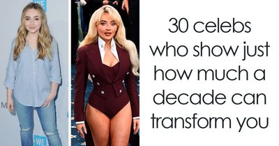 “What’s With The Cadaver Look?”: 30 Celebs Who Show Just How Much A Decade Can Transform You