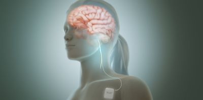 Vagus nerve stimulation: from TikTok tips to clinical trials