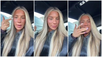 ‘These young people do anything’: Server wears under-eye and pimple patches at work and the whole internet has turned against her