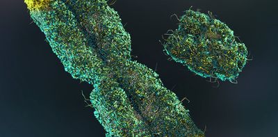 Men lose their Y chromosome as they age. Scientists thought it didn’t matter – but now we’re learning more