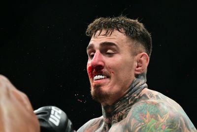 Tom Aspinall undergoes second eye surgery amid fears over UFC future