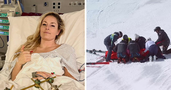 Lindsey Vonn May Face Leg Loss After Horrific Winter Olympics Crash