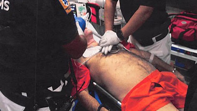 'Likely caused by strangulation': Doctor who observed Jeffrey Epstein autopsy makes shock claim about his death