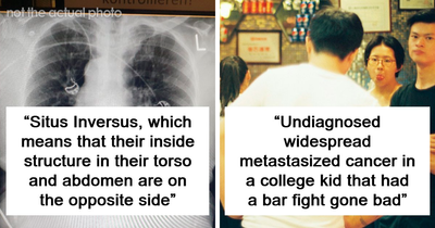 40 Autopsy Doctors Share The Most Bizarre Cases They’ve Ever Seen