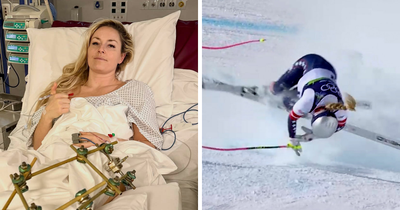 Major Update On Olympian Lindsey Vonn After Horrific Crash That May Cost Her A Leg