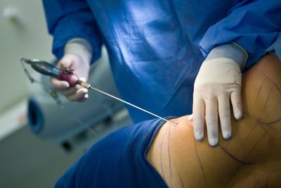 MPs call for an immediate ban on this cosmetic surgery