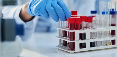 The next cancer breakthrough may be stopping it before it starts