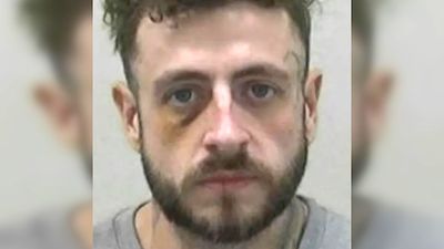 Man gives children ‘temporary tattoos’ with Amazon-purchased kit. What follows next is an infection, urgent antibiotics, and therapy