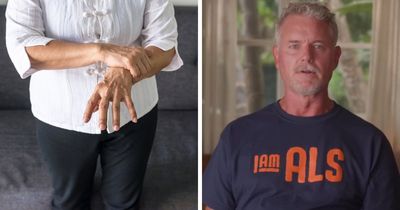 Doctors Break Down Commonly Ignored ALS Symptoms After Eric Dane’s Hand Claim