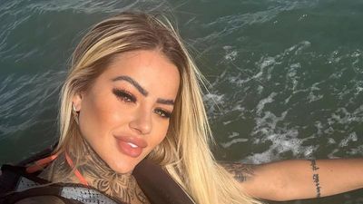 Influencer Bianca Dias dies at 27 after a plastic surgery complication