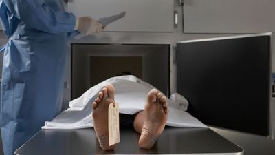 What is rigor mortis, and why does it happen?