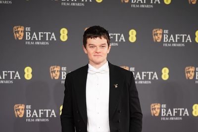 I Swear filmmaker did not ask Robert Aramayo to audition for lead role