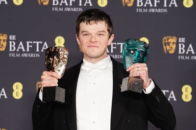 Robert Aramayo triumphs over Leonardo DiCaprio and Timothée Chalamet in shock Bafta win