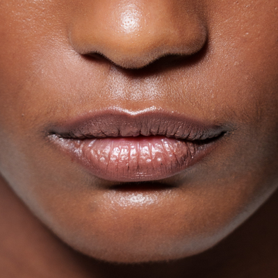 You Can Now Get Polynucleotides Injected Into Your Lips—Here’s How the Results Compare to Filler
