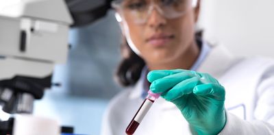 Can blood tests really detect cancer?