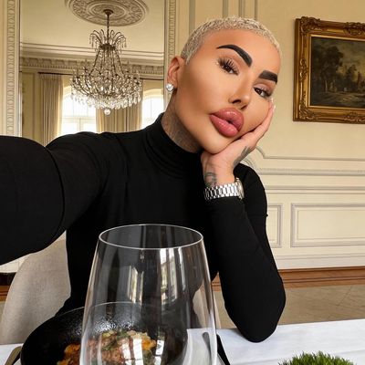 Two arrested after ‘Lip King’ dies in Canary Wharf 'after undergoing cosmetic surgery'