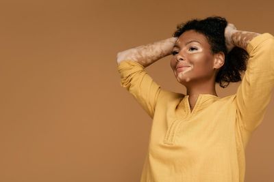 First licensed treatment for vitiligo set to be rolled out across NHS