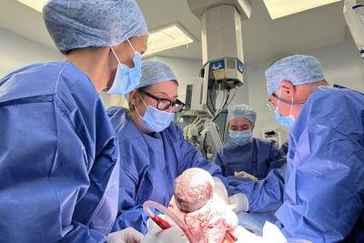Pioneering womb transplant doctors describe moment of joy as baby Hugo entered the world