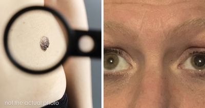 “Nearly Cost Me My Life”: 82 Body Warning Signs You Shouldn’t Brush Off