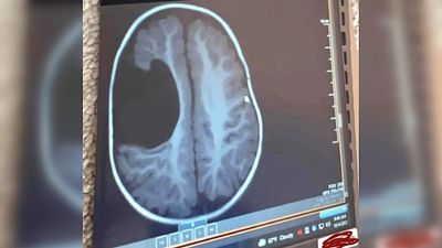 ‘Funniest but WTF things that’s ever happened to me’: Woman learns from viral meme a ‘voice in her head’ told her she has tumor