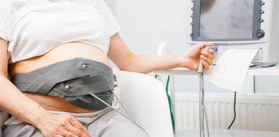 Good maternity care needs good science – but there’s more research on marathon running than giving birth