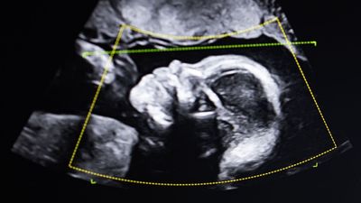 'It doesn't lie. So who are you?': What happens when DNA tests show a woman is not the mother of the child she gave birth to?