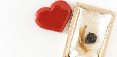 From kneecap necklaces to umbilical cord keepsakes: the risks of keeping and consuming human tissue