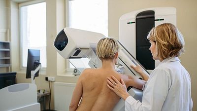 Breast cancer cases set to reach 3.5 million by 2050, study finds