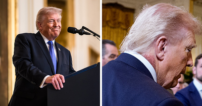 Doctors Weigh In On Trump’s Neck Rash, Suggesting Likely Cause Amid White House’s ‘Preventative Treatment’ Claim