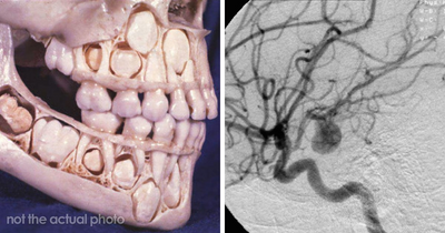 “Either God Or Evolution Is A Terrible Designer”: 59 Things That Freak People Out About Their Own Bodies