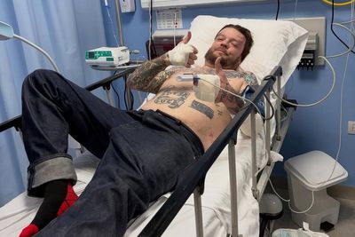 Pawn Stars’ Corey Harrison launches GoFundMe to help pay $100,000 medical bills after horrific motorcycle crash