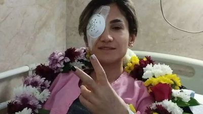 ‘Where were you when we were shot?’: Iranian activist who lost her eye slams Kamala Harris for opposing US strikes