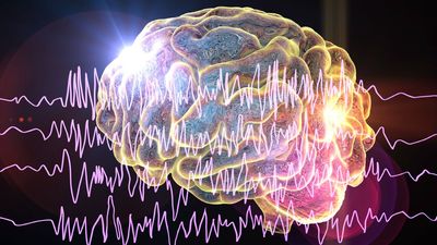 In people with epilepsy, sleeping after a seizure may trigger more seizures