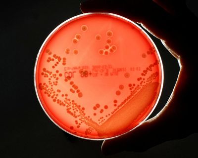 Pipeline of new drugs to fight superbugs is ‘worryingly thin’, experts warn