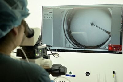 I’m a fertility expert. Here’s what you should know before freezing your eggs