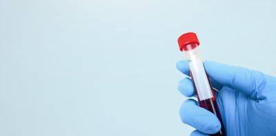 Blood tests for cancer? We’re still a way off