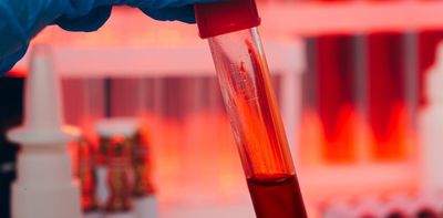 Rising CO₂ levels are reflected in human blood. Scientists don’t know what it means