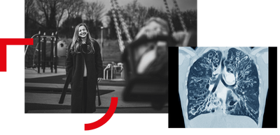 ‘I’m alive because of the research’: how a cystic fibrosis breakthrough gave me a future